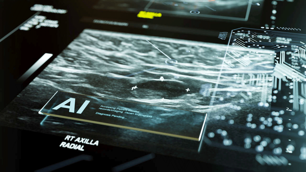 Inteligencia artificial revoluciona la medicina: detecta cáncer y enfermedades raras antes de que sea tarde