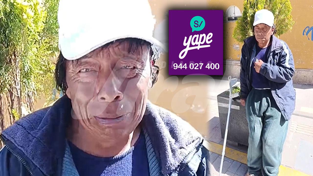 Varón accidentado pide solidaridad tras 30 años de sufrimiento