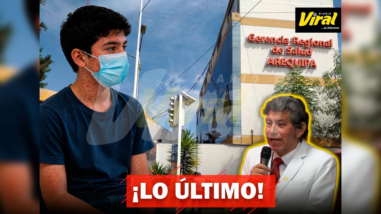 Arequipa confirma trece casos de sarampión