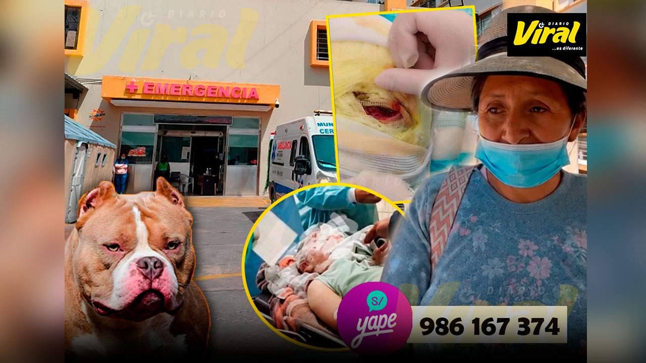 Joven atacada por perros en Puno lucha por su vida en Arequipa