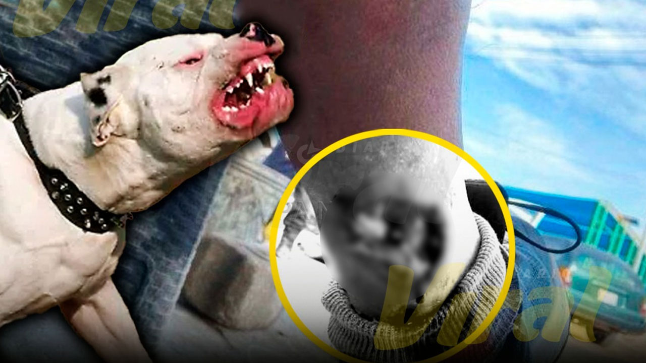 Adulto mayor quedó con hueso expuesto tras ataque de perro