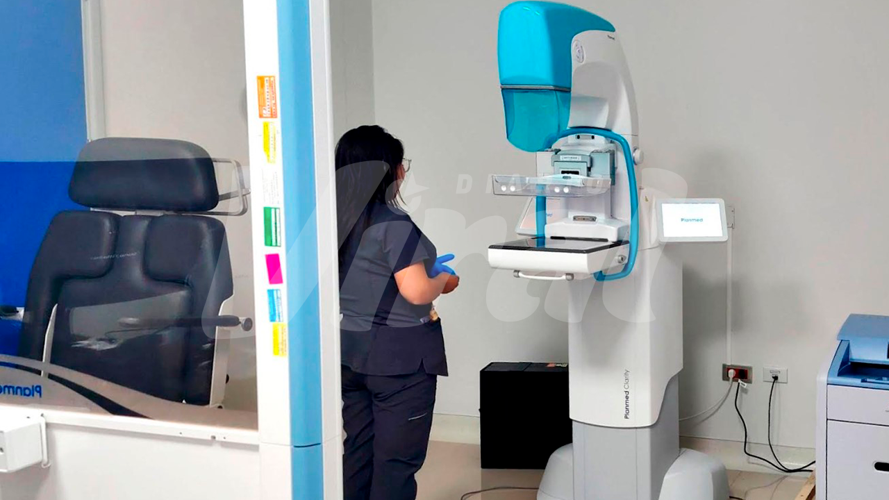 Hospital de Moquegua utilizó mamógrafo en mal estado