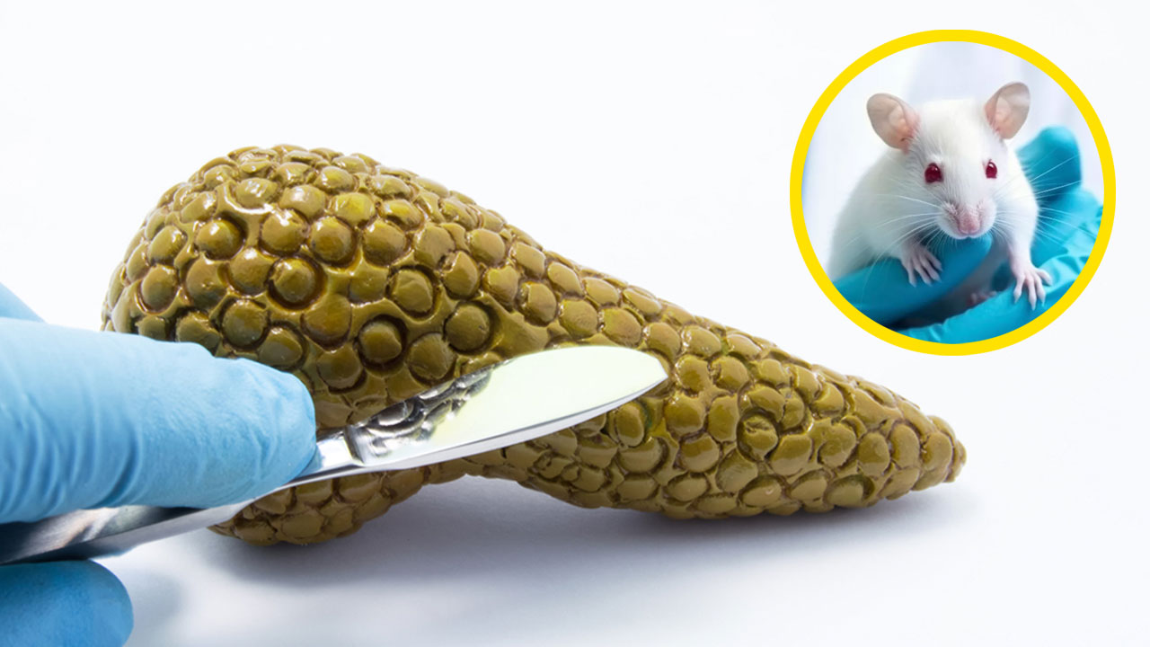 ¡Avance histórico! Eliminan tumores de cáncer de páncreas en ratones